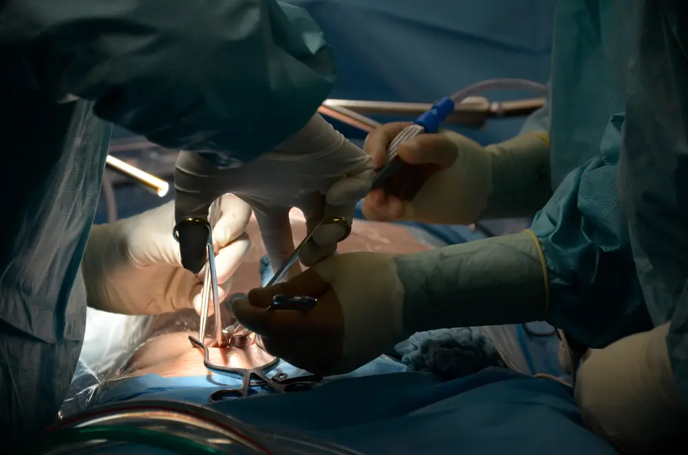 Open heart surgery photo 0003