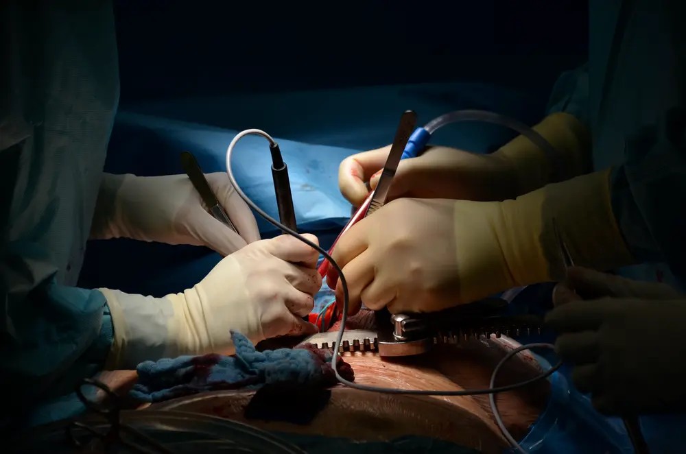 Open heart surgery photo 0005